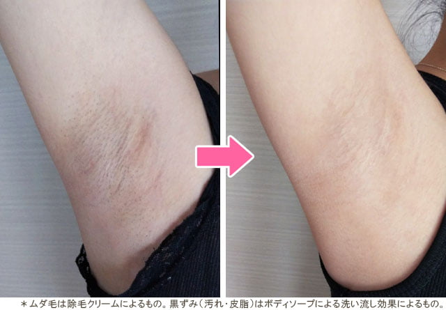 ワキのムダ毛ケア